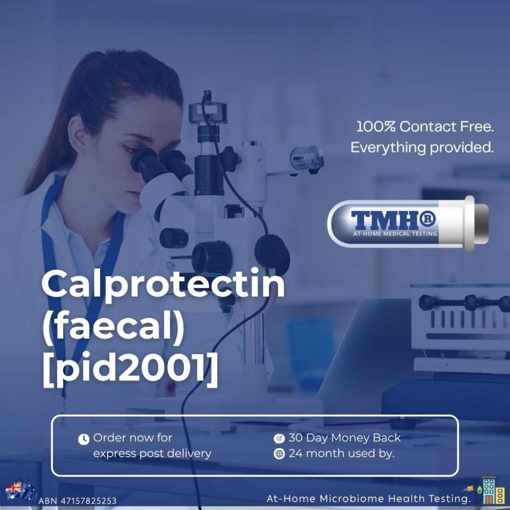 Calprotectin (faecal)